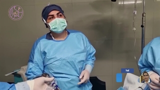 جراحی لاپاراسکوپی کیست تخمدان