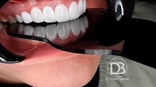 بهترین دندانپزشک لمینت سرامیکی در شهرکرد