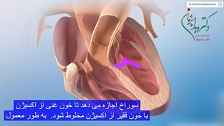 تترالوژی فالوت