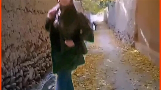 فرشته سوری تزریق چربی