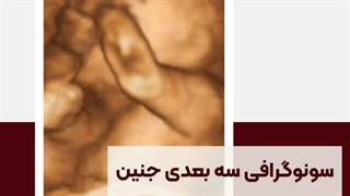 سونوگرافی سه بعدی جنین