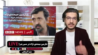 14020326: شارمین میمندی نژاد در مسیر پدر! جراحی زیبایی پلک