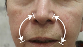 قبل و بعد از انجام کار زیبایی