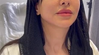 زاویه سازی فک و رضایت مراجعه کننده 1 - کلینیک مهزیار