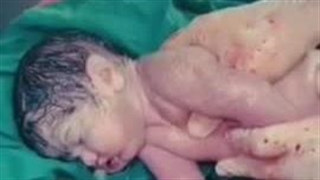 امید اگر انسان بود