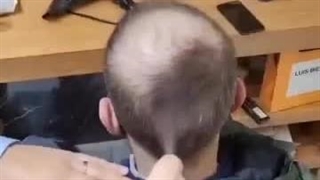 پرپشت کننده مو با اسپری تاپیک لوییس بین