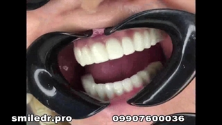 متخصص ایمپلنت تهران از نگاه هوش مصنوعی