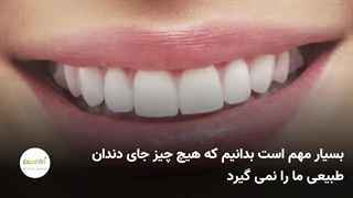 آشنایی با درمان بیلداپ دندان به زبان ساده