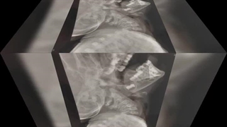 فوق تخصص حنجره در تهران، دکتر زهرا سرافراز