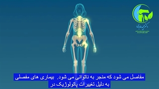 التهاب مفاصل کلینیک لیزر