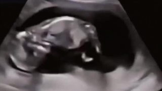 حرکت های جنین در ماه های آخر بارداری