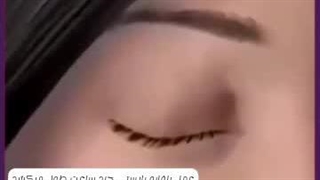 عمل بلفارو چند ساعت طول میکشد