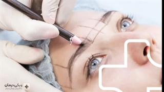 بهترین کلینیک کاشت ابرو در تهران