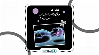 خواب مغز - داروخانه آنلاین نسخه اول - داروخانه اینترنتی نسخه اول