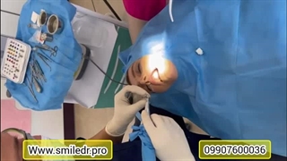 فیلم ایمپلنت دندان هر روز در دندانپزشکی دکتر الیاهو