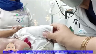 ختنه معجزه آسا بدون درد بدون خونریزی بدون بیهوشی کلینیک دکتر بلندی