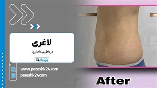 کلینیک لاغری ایوا بهترین مرکز زیبایی و لاغری در تهران