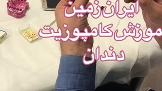 آموزش کامپوزیت دندان 