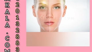 کرم ضد لک و روشن کننده ریلاکو /09120750932 اکستنشن تاج دندان