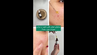 روغن شمعدانی موضعی (گیاه کالا)