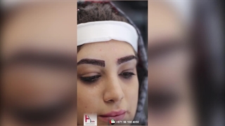 زراعة الحواجب الدائمة على التاتو فی جلسة واحدة