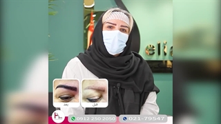 کاشت ابرو باورنکردنی همسر بازیگر شهروز ابراهیمی