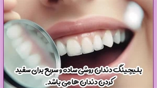 هزینه بلیچینگ دندان رفع افتادگی پلک