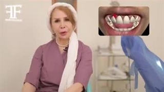 آبسه دندان: علائم، درمان و پیشگیری