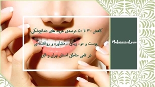 لمینت دندان (لامینت دندان)