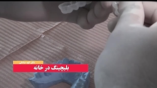 بلیچینگ چیست