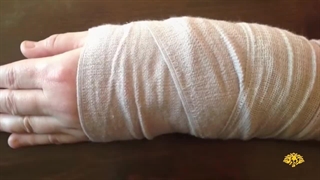 معجزه عسل برای سوختگی