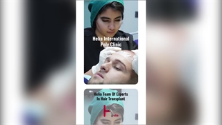 Hair Transplantation, a Path to an Ideal Appearance