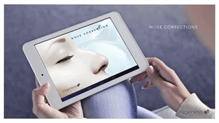 معرفی فیلر آلجنس