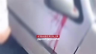 تصاویر دلخراش از ترور 2 بسیجی در سراوان