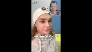 جراحی لیفت دیپ پلین صورت و گردن | چند سال جوونتر شدند؟