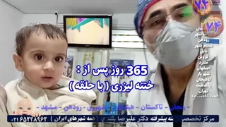 ختنه نوزادان